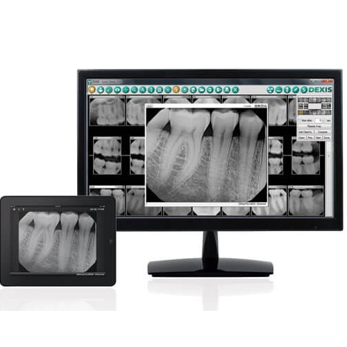 Dexis Digital Scanner